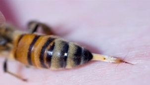 Arı Sokmasına Ne İyi Gelir 