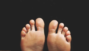 Diyabetik Ayak Nedir ve Nasıl Tedavi Edilir?