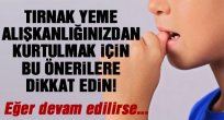Tırnak yeme alışkanlığı nasıl bırakılır?